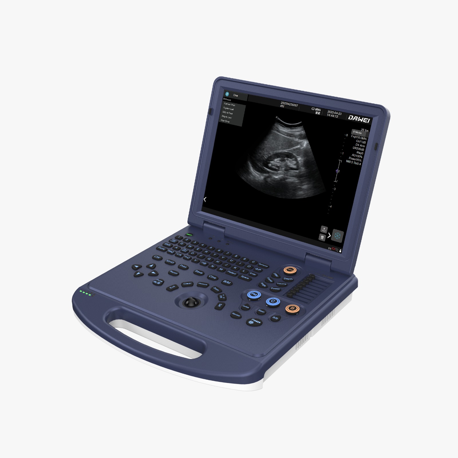 DW L3i Colour-Doppler with Convex Probe